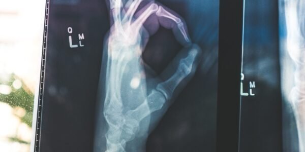 kozi ya radiology husaidia kufanya uchunguzi wa XRays
